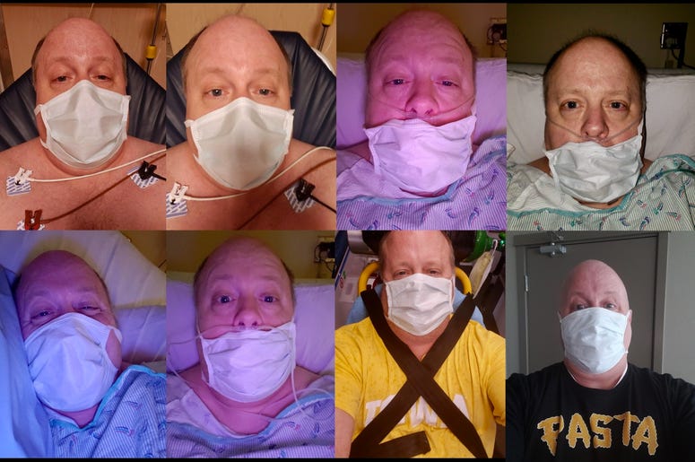 The face of COVID-19, on my friend Jim Ziegler.