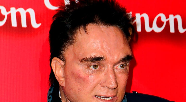 ILE - In this Feb. 18, 2012, file photo, Roy Horn, of Siegfried & Roy, arrives at the Keep Memory Alive 16th Annual "Power of Love Gala," honoring Muhammad Ali with his 70th birthday celebration in Las Vegas.