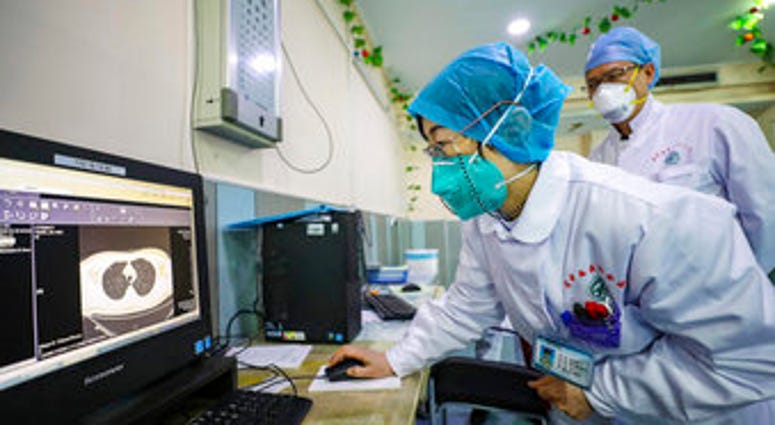 Doctors look at a CT scan of a patient at a hospital in Wuhan in central China's Hubei Province, Thursday, Jan. 30, 2020. China counted 170 deaths from a new virus Thursday and more countries reported infections. (Chinatopix via AP) Doctors look at a CT scan of a patient at a hospital in Wuhan in central China's Hubei Province, Thursday, Jan. 30, 2020. China counted 170 deaths from a new virus Thursday and more countries reported infections. (Chinatopix via AP)