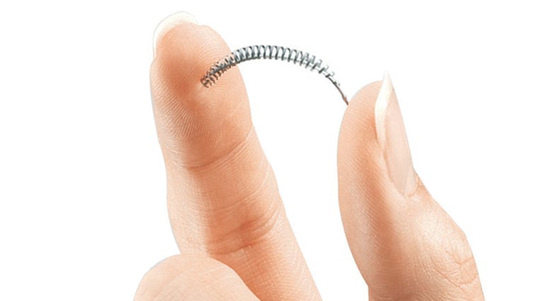 FILE - This image provided by Bayer Healthcare Pharmaceuticals shows the birth control implant Essure. On Friday, July 20, 2018, the maker of the permanent contraceptive implant subject to thousands of injury reports from women and repeated safety restric