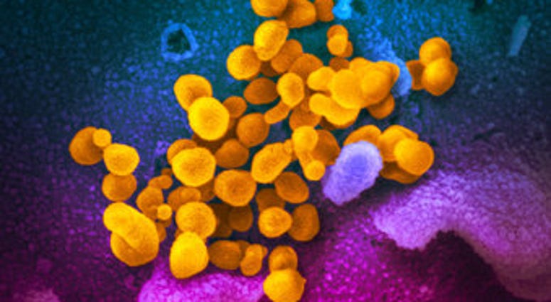 This undated electron microscope image made available by the U.S. National Institutes of Health in February 2020 shows the Novel Coronavirus SARS-CoV-2, yellow, emerging from the surface of cells, blue/pink, cultured in the lab. (NIAID-RML via AP) This undated electron microscope image made available by the U.S. National Institutes of Health in February 2020 shows the Novel Coronavirus SARS-CoV-2, yellow, emerging from the surface of cells, blue/pink, cultured in the lab. (NIAID-RML via AP)