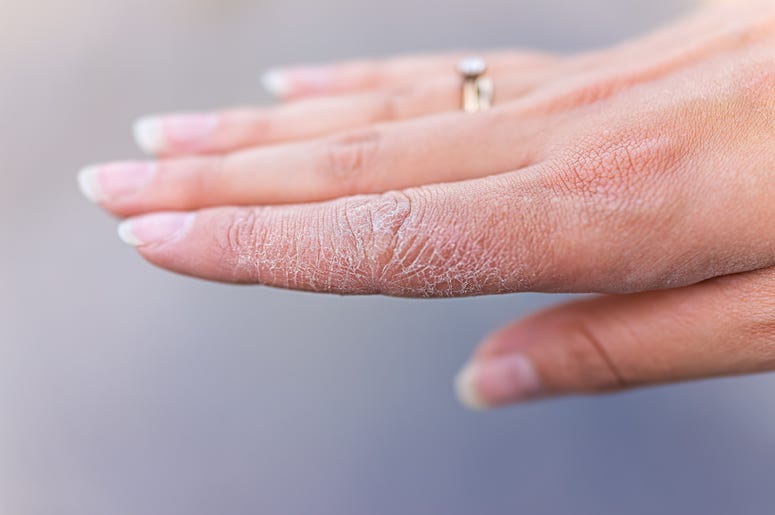 Dry Hands