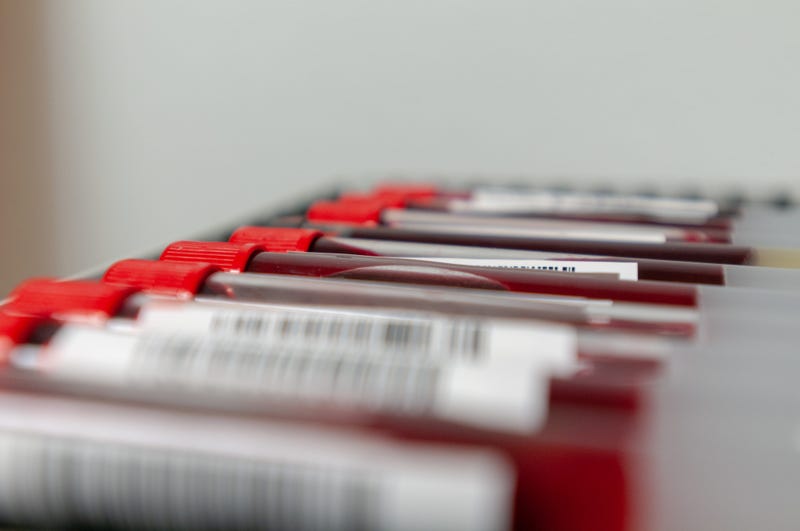 Blood Test Vials