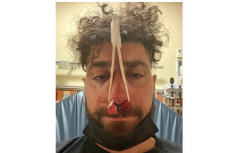 TonyAversa GOFUNDME