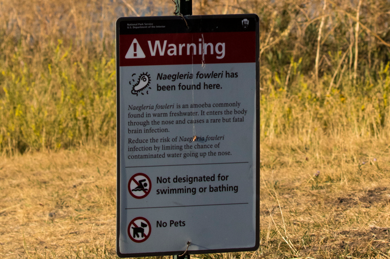 Naegleria fowleri warning sign