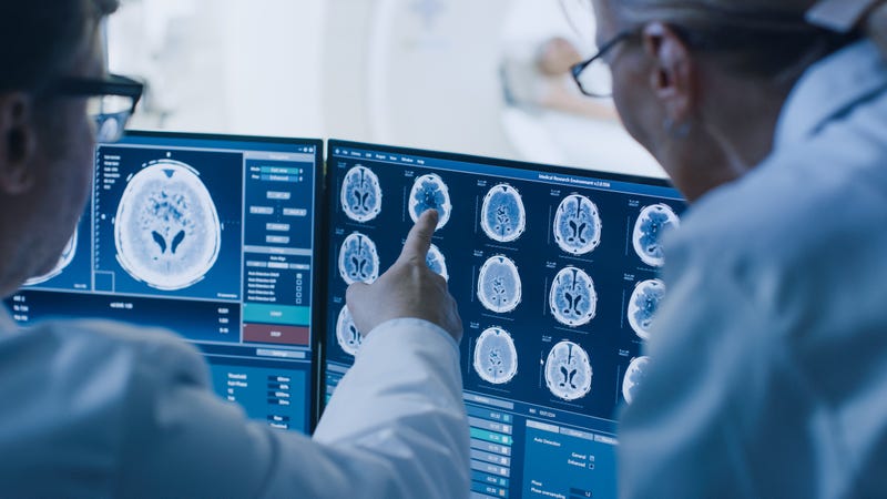 brain scan