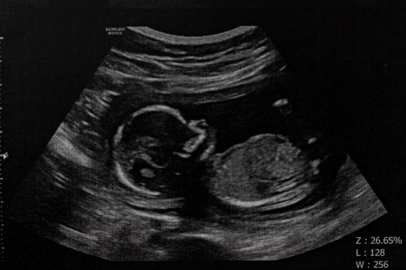 Baby