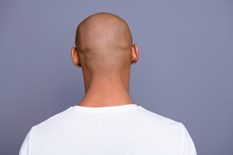 Bald man