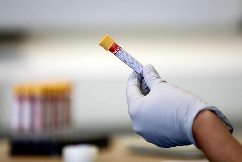 A paramedic holds a test tube containing a blood sample at an antibody testing program at the Hollymore Ambulance Hub of the West Midlands Ambulance Service, operated by the West Midlands Ambulance Service NHS Foundation Trust, on June 5, 2020 in Birmingham, England.