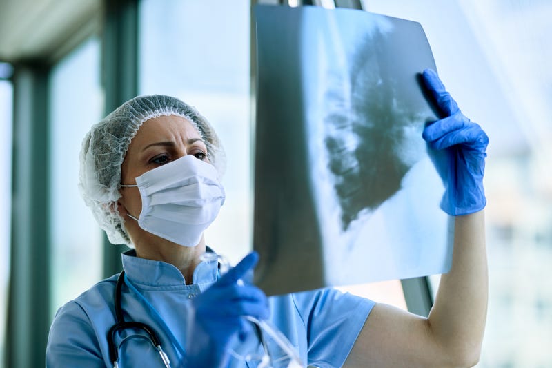 radiologist analyzing chest X-ray of a patient
