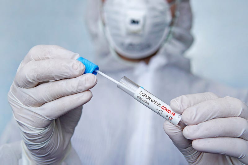 Coronavirus 2019-nCoV Sample