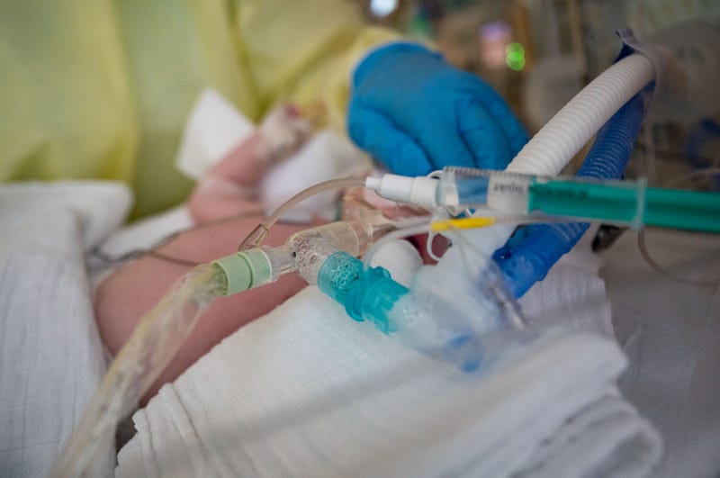 An intensive care nurse ventilates a patient with RSV.