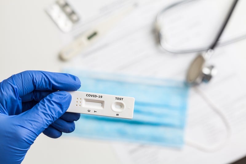 COVID-19 virus disease healthcare check,Coronavirus global pandemic outbreak crisis,Rapid Strep Test RST kit,Quick Antigen Detection Testing RADT, patient fast antibody specimen serological analysis
