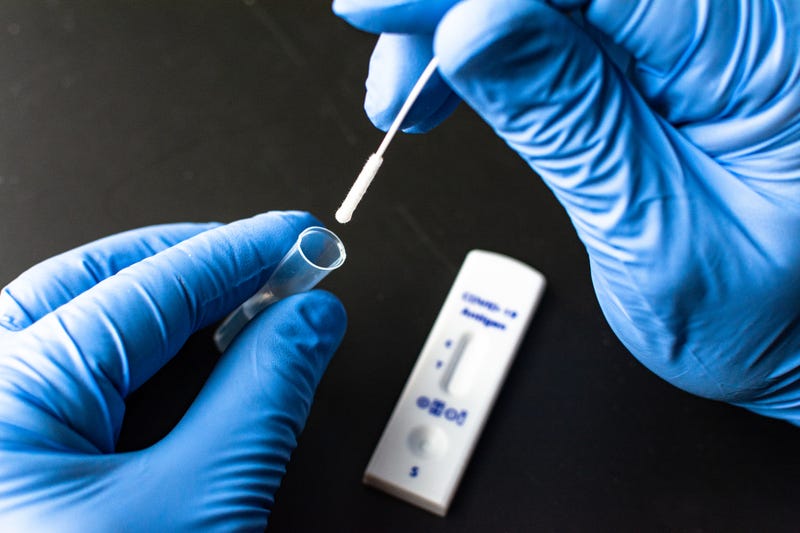 Testing manufacturers are not capable of meeting demand right now.