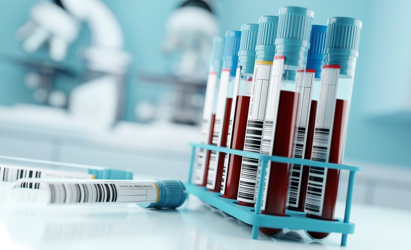 Blood test results in a lab.