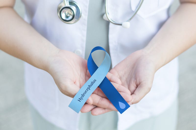 Blue ribbon (2 tone) for National Hydrocephalus Awareness month in September