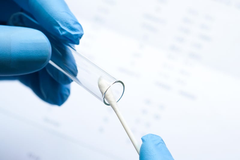 DNA Testing