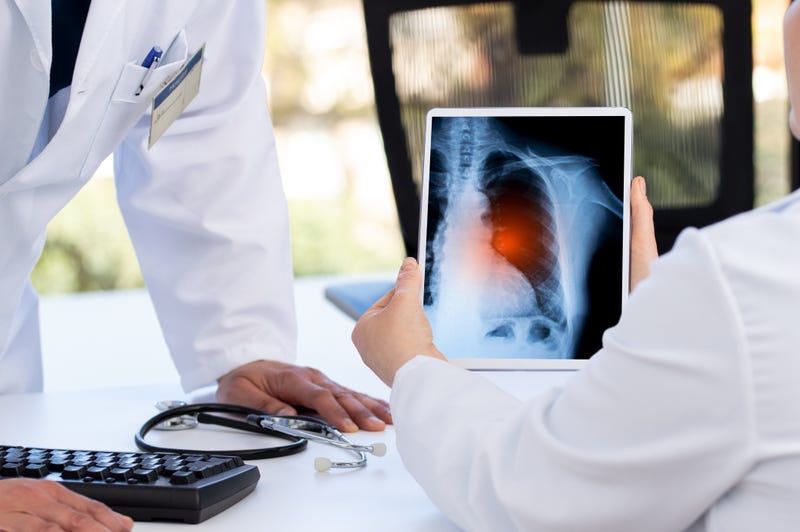 As health experts gain a further understanding about long COVID-19, some are warning that the condition is more common than we previously thought.