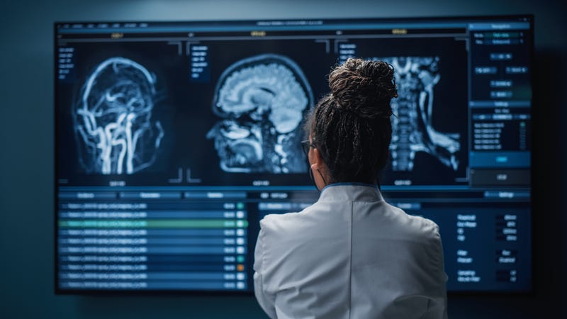 doctor looks at brain scans