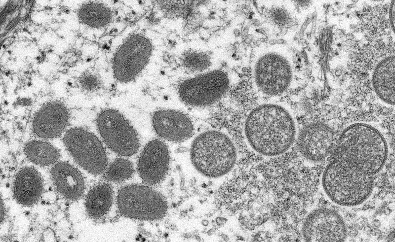 Electron microscope image of various virions (virus particles) of the monkeypox virus taken from human skin, 2003.
