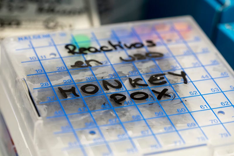 A reactive to test suspected monkeypox samples is seen inside a fridge at a microbiology laboratory.