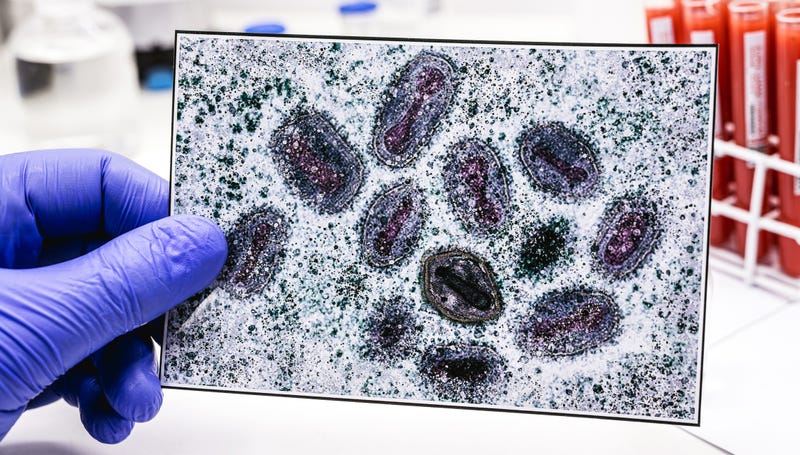 WHO renames monkeypox as mpox, citing racism concerns