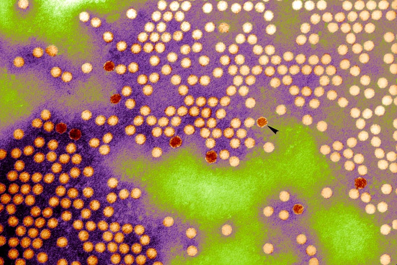 Poliovirus. Transmission Electron Micrograph Of Poliovirus Type 1. Virions Are 20 30 Nm In Diameter And Have Icosahedral Symmetry.