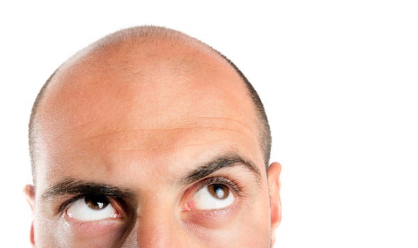 Bald man looking up