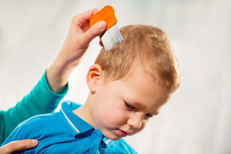 Child being checked for lice stock photo.