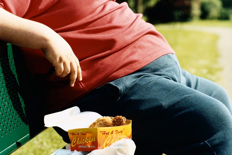 obesity