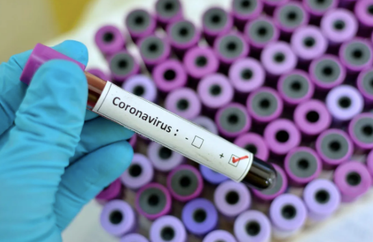 Coronavirus positive