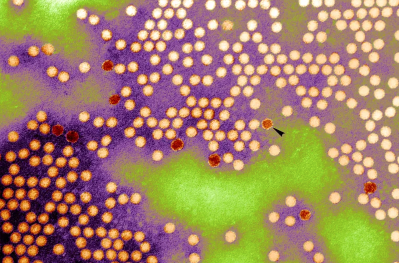 Poliovirus. Transmission Electron Micrograph Of Poliovirus Type 1. Virions Are 20 30 Nm In Diameter And Have Icosahedral Symmetry.