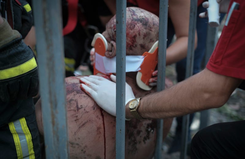 APTOPIX Russia Ukraine War