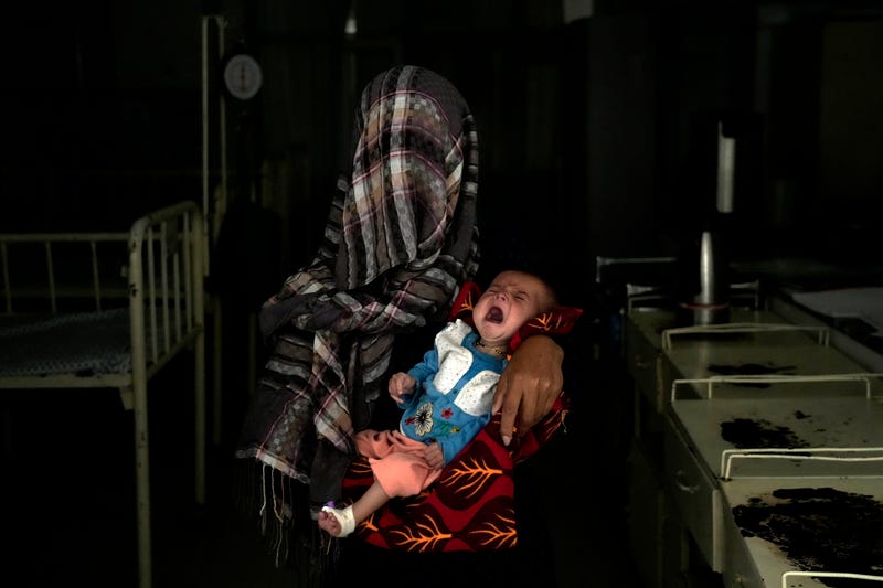 Afghanistan Malnutrition