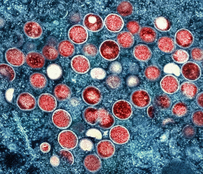 Mpox