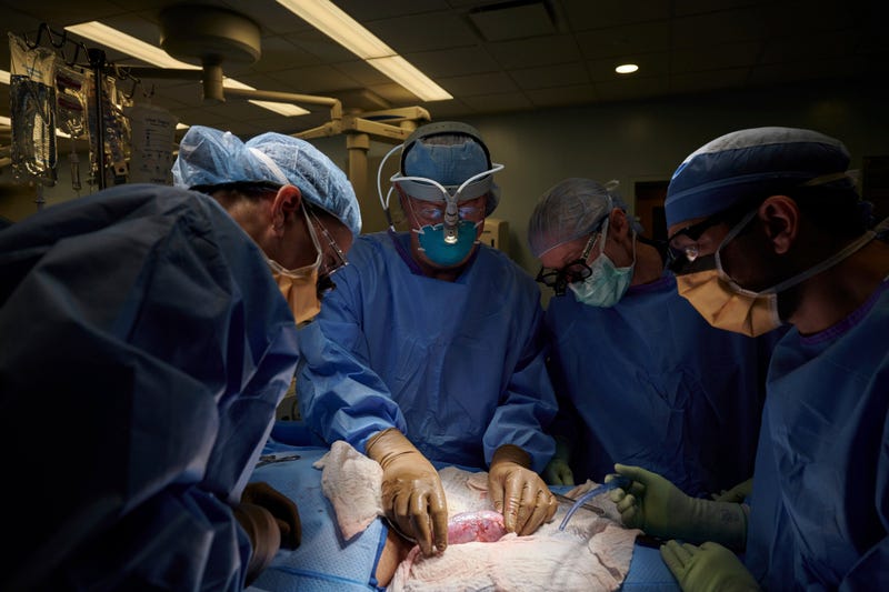 Animal To Human Organs