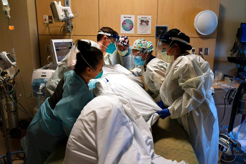 FILE - In this Nov. 19, 2020, file photo, medical personnel prone a COVID-19 patient at Providence Holy Cross Medical Center in the Mission Hills section of Los Angeles.