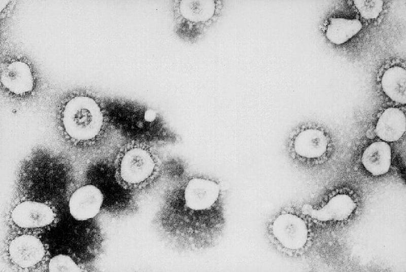 Microscope shot of Coronavirus