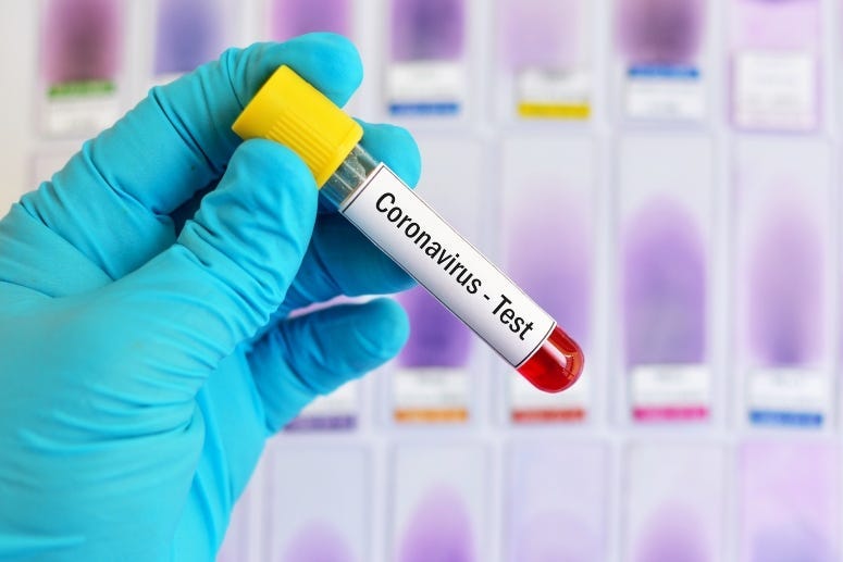 Coronavirus test