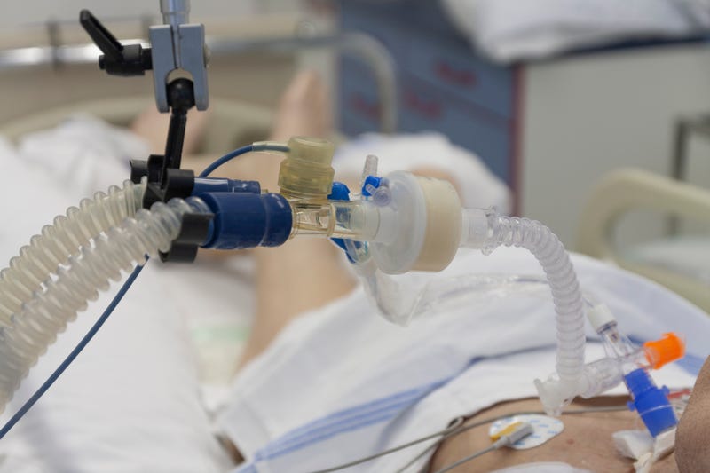 Patient connected to medical ventilator in ICU in hospital