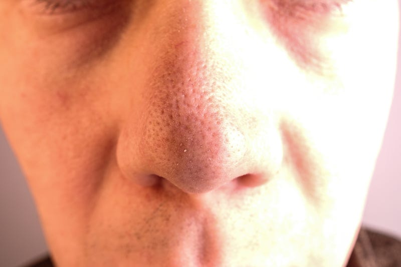 Nose