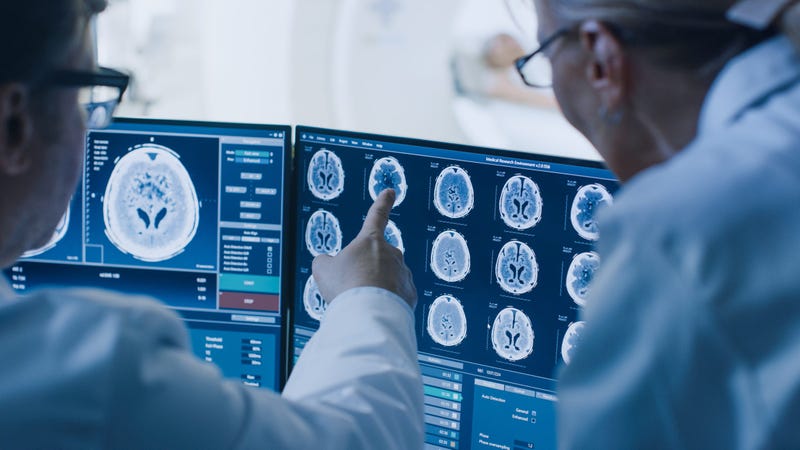 Hospital, Brain Scan
