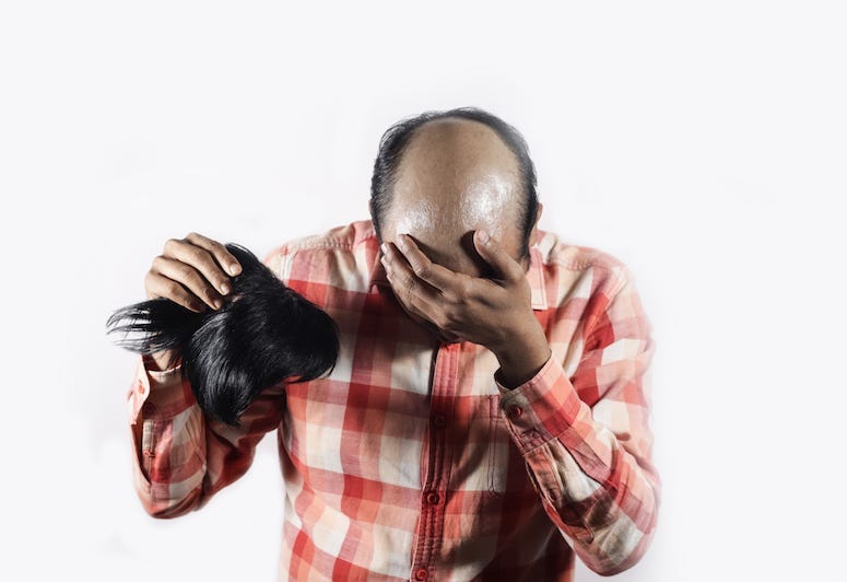Bald, Man, Wig, Toupee, Shame
