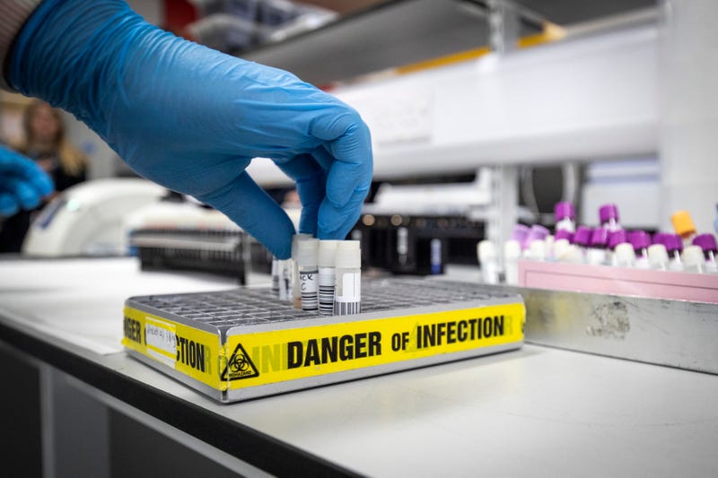 Clinical support technician Douglas Condie extracts viruses from swab samples so that the genetic structure of a virus can be analysed and identified in the coronavirus testing laboratory at Glasgow Royal Infirmary, on February 19, 2020 in Scotland