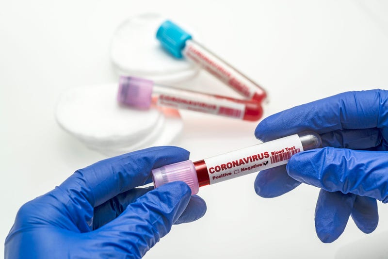 Coronavirus Test
