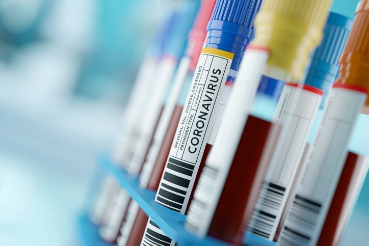 coronavirus, hospital lab
