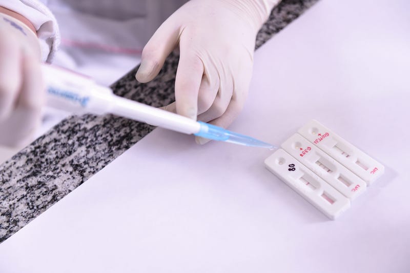 BELO HORIZONTE, BRAZIL - MARCH 24: Anna Raquel Ribeiro dos Santos, works in the standardization of a rapid test for the diagnosis of the disease on March 24, 2020 in Belo Horizonte, Brazil.
