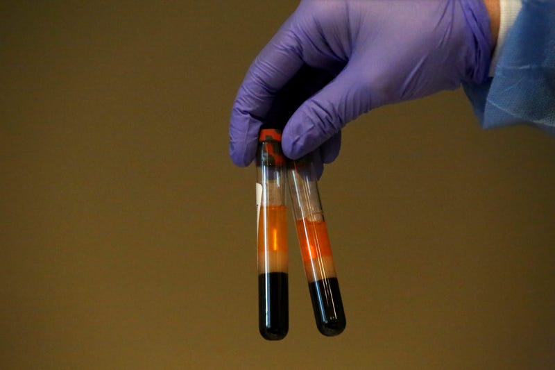 SPRING VALLEY, NY - APRIL 24: A phlebotomist shows to the camera specimens of people getting tested for coronavirus antibodies at the Refuah Health Center on April 24, 2020 in Spring Valley, New York.