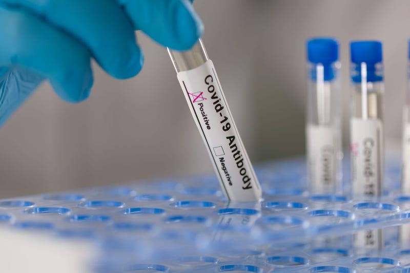 Dillons announces coronavirus rapid antibody testing at all pharmacy locations