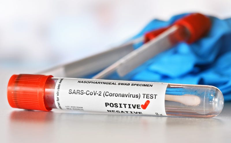 Coronavirus Test